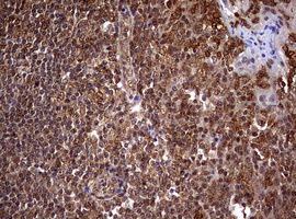 USP44 Antibody - IHC of paraffin-embedded Human tonsil using anti-USP44 mouse monoclonal antibody. (Heat-induced epitope retrieval by 10mM citric buffer, pH6.0, 120°C for 3min).