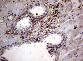 USP44 Antibody - IHC of paraffin-embedded Human prostate tissue using anti-USP44 mouse monoclonal antibody. (Heat-induced epitope retrieval by 10mM citric buffer, pH6.0, 120°C for 3min).