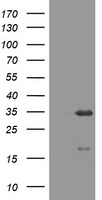 USP44 Antibody - E.coli lysate (left lane) and E.coli lysate expressing human recombinant protein fragment corresponding to amino acids 420-712 of human USP44 (NP_115523) were separated by SDS-PAGE and immunoblotted with anti-USP44.