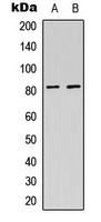 USP44 Antibody - Western blot analysis of USP44 expression in K562 (A); Jurkat (B) whole cell lysates.