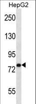 USP45 Antibody - USP45 Antibody western blot of HepG2 cell line lysates (35 ug/lane). The USP45 antibody detected the USP45 protein (arrow).