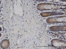 USP45 Antibody - Immunoperoxidase of monoclonal antibody to USP45 on formalin-fixed paraffin-embedded human small Intestine. [antibody concentration 3 ug/ml]