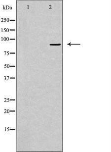 USP45 Antibody - Western blot analysis of extracts of A549 cells using USP45 antibody. The lane on the left is treated with the antigen-specific peptide.