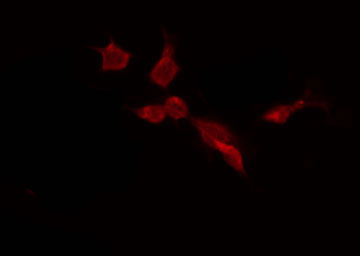 USP45 Antibody - Staining HepG2 cells by IF/ICC. The samples were fixed with PFA and permeabilized in 0.1% Triton X-100, then blocked in 10% serum for 45 min at 25°C. The primary antibody was diluted at 1:200 and incubated with the sample for 1 hour at 37°C. An Alexa Fluor 594 conjugated goat anti-rabbit IgG (H+L) Ab, diluted at 1/600, was used as the secondary antibody.