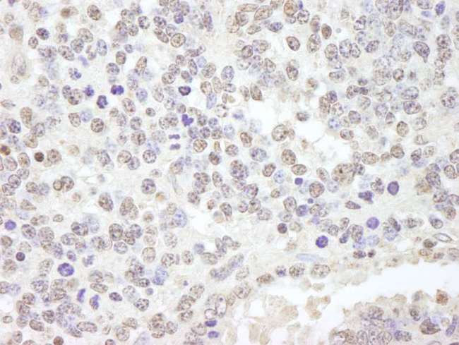 USP47 Antibody - Detection of Mouse USP47 by Immunohistochemistry. Sample: FFPE section of mouse teratoma. Antibody: Affinity purified rabbit anti-USP47 used at a dilution of 1:250.