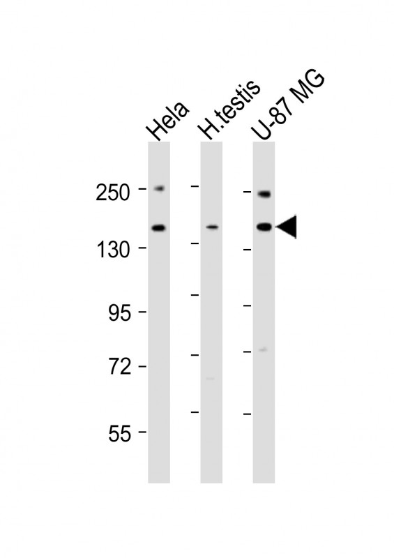 USP47 Antibody - All lanes: Anti-USP47 Antibody (Center) at 1:2000 dilution. Lane 1: HeLa whole cell lysates. Lane 2: human testis lysates. Lane 3: U-87 MG whole cell lysates Lysates/proteins at 20 ug per lane. Secondary Goat Anti-Rabbit IgG, (H+L), Peroxidase conjugated at 1:10000 dilution. Predicted band size: 157 kDa. Blocking/Dilution buffer: 5% NFDM/TBST.