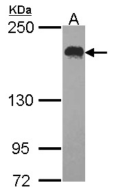 USP47 Antibody - Sample (30 ug of whole cell lysate). A: Hela. 5% SDS PAGE. USP47 antibody. USP47 antibody diluted at 1:1000.
