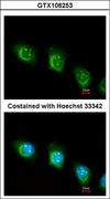 USP47 Antibody - Immunofluorescence of methanol-fixed HeLa using USP47 antibody at 1:200 dilution.
