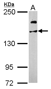 USP47 Antibody - Sample (50 ug of whole cell lysate). A: Mouse brain. 5% SDS PAGE. USP47 antibody diluted at 1:1000.