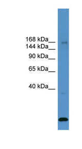 USP47 Antibody - USP47 antibody Western blot of ACHN lysate.  This image was taken for the unconjugated form of this product. Other forms have not been tested.