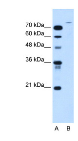 USP48 Antibody - USP48 antibody ARP44805_T100-AAH67261-USP48(ubiquitin specific peptidase 48) Antibody Western blot of HepG2 cell lysate.  This image was taken for the unconjugated form of this product. Other forms have not been tested.