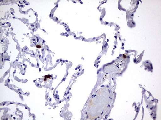 USP48 Antibody - Immunohistochemical staining of paraffin-embedded Human lung tissue using anti-USP48 mouse monoclonal antibody.