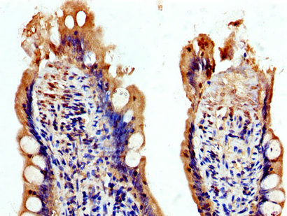 USP48 Antibody - Immunohistochemistry image at a dilution of 1:200 and staining in paraffin-embedded human small intestine tissue performed on a Leica BondTM system. After dewaxing and hydration, antigen retrieval was mediated by high pressure in a citrate buffer (pH 6.0) . Section was blocked with 10% normal goat serum 30min at RT. Then primary antibody (1% BSA) was incubated at 4 °C overnight. The primary is detected by a biotinylated secondary antibody and visualized using an HRP conjugated SP system.