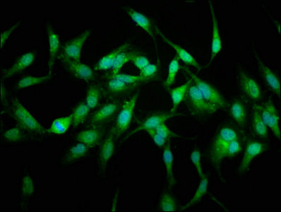 USP48 Antibody - Immunofluorescence staining of Hela cells with USP48 Antibody at 1:66, counter-stained with DAPI. The cells were fixed in 4% formaldehyde, permeabilized using 0.2% Triton X-100 and blocked in 10% normal Goat Serum. The cells were then incubated with the antibody overnight at 4°C. The secondary antibody was Alexa Fluor 488-congugated AffiniPure Goat Anti-Rabbit IgG(H+L).