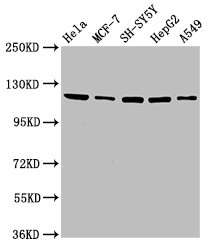 USP48 Antibody - Western Blot Positive WB detected in: Hela whole cell lysate, MCF-7 whole cell lysate, SH-SY5Y whole cell lysate, HepG2 whole cell lysate, A549 whole cell lysate All lanes: USP48 antibody at 3.5µg/ml Secondary Goat polyclonal to rabbit IgG at 1/50000 dilution Predicted band size: 120, 113, 82, 46, 60, 18, 57, 121 kDa Observed band size: 120 kDa