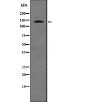 USP48 Antibody - Western blot analysis of USP48 expression in HeLa cells lysate. The lane on the left is treated with the antigen-specific peptide.