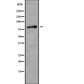 USP49 Antibody - Western blot analysis USP49 using Jurkat whole cells lysates