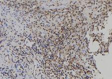 USP49 Antibody - 1:100 staining human spleen tissue by IHC-P. The sample was formaldehyde fixed and a heat mediated antigen retrieval step in citrate buffer was performed. The sample was then blocked and incubated with the antibody for 1.5 hours at 22°C. An HRP conjugated goat anti-rabbit antibody was used as the secondary.