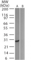USP5 Antibody - Western blot of GFP in 20 ugs of A) transfected HeLa cells and B) untransfected HeLa cells using USP5 Antibody at 0.5 ug/ml.