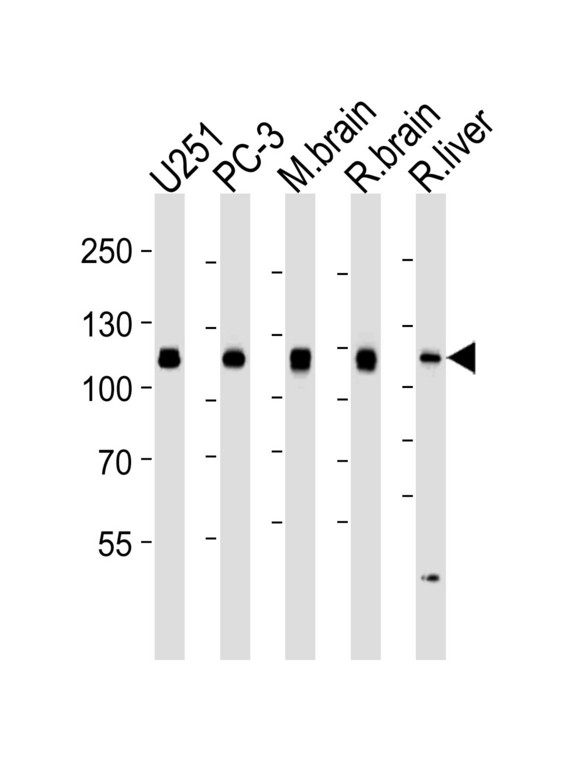 USP5 Antibody - Western blot of lysates from U251, PC-3 cell line, mouse brain, rat brain and liver tissue lysates (from left to right) with USP5 Antibody. Antibody was diluted at 1:1000 at each lane. A goat anti-mouse IgG H&L (HRP) at 1:3000 dilution was used as the secondary antibody. Lysates at 35 ug per lane.
