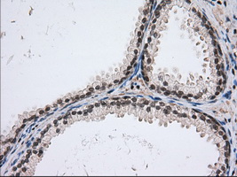 USP5 Antibody - Immunohistochemical staining of paraffin-embedded Human prostate tissue using anti-USP5 mouse monoclonal antibody. (Dilution 1:50).