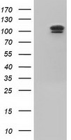 USP5 Antibody - HEK293T cells were transfected with the pCMV6-ENTRY control (Left lane) or pCMV6-ENTRY USP5 (Right lane) cDNA for 48 hrs and lysed. Equivalent amounts of cell lysates (5 ug per lane) were separated by SDS-PAGE and immunoblotted with anti-USP5.