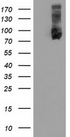 USP5 Antibody - HEK293T cells were transfected with the pCMV6-ENTRY control (Left lane) or pCMV6-ENTRY USP5 (Right lane) cDNA for 48 hrs and lysed. Equivalent amounts of cell lysates (5 ug per lane) were separated by SDS-PAGE and immunoblotted with anti-USP5.