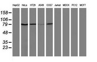 USP5 Antibody - Western blot of extracts (35ug) from 9 different cell lines by using anti-USP5 monoclonal antibody.