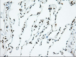 USP5 Antibody - IHC of paraffin-embedded Human lung tissue using anti-USP5 mouse monoclonal antibody. (Dilution 1:50).