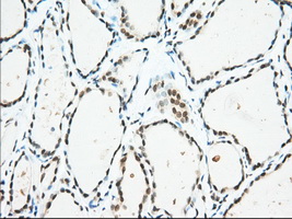USP5 Antibody - IHC of paraffin-embedded Human thyroid tissue using anti-USP5 mouse monoclonal antibody. (Dilution 1:50).