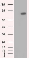 USP5 Antibody - HEK293T cells were transfected with the pCMV6-ENTRY control (Left lane) or pCMV6-ENTRY USP5 (Right lane) cDNA for 48 hrs and lysed. Equivalent amounts of cell lysates (5 ug per lane) were separated by SDS-PAGE and immunoblotted with anti-USP5.