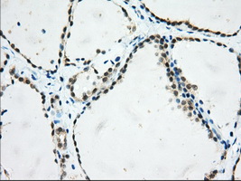 USP5 Antibody - IHC of paraffin-embedded Human thyroid tissue using anti-USP5 mouse monoclonal antibody. (Dilution 1:50).