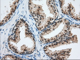 USP5 Antibody - IHC of paraffin-embedded Human prostate tissue using anti-USP5 mouse monoclonal antibody. (Dilution 1:50).