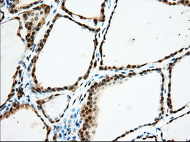 USP5 Antibody - IHC of paraffin-embedded Human thyroid tissue using anti-USP5 mouse monoclonal antibody. (Dilution 1:50).