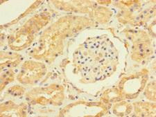 USP5 Antibody - Immunohistochemistry of paraffin-embedded human kidney tissue using USP5 Antibody at dilution of 1:100