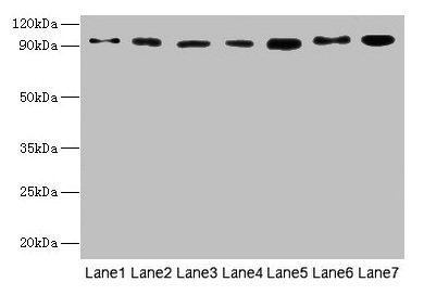 USP5 Antibody - Western blot All lanes: USP5 antibody at 10µg/ml Lane 1: Mouse liver tissue Lane 2: Mouse brain tissue Lane 3: A549 whole cell lysate Lane 4: MCF-7 whole cell lysate Lane 5: A375 whole cell lysate Lane 6: U251 whole cell lysate Lane 7: HL60 whole cell lysate Secondary Goat polyclonal to rabbit IgG at 1/10000 dilution Predicted band size: 96, 94 kDa Observed band size: 96 kDa