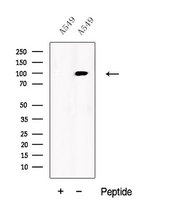 USP5 Antibody - Western blot analysis of extracts of A549 cells using UBP5 antibody. The lane on the left was treated with blocking peptide.