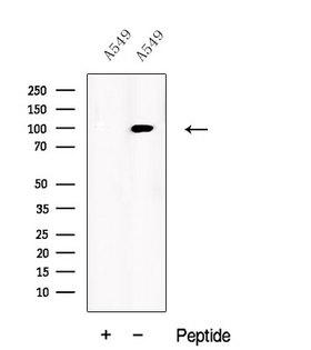 USP5 Antibody - Western blot analysis of extracts of A549 cells using UBP5 antibody. The lane on the left was treated with blocking peptide.