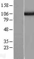USP5 Protein - Western validation with an anti-DDK antibody * L: Control HEK293 lysate R: Over-expression lysate