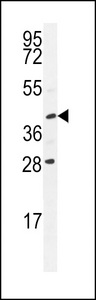 USP50 Antibody - USP50 Antibody western blot of Y79 cell line lysates (35 ug/lane). The USP50 antibody detected the USP50 protein (arrow).