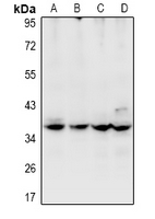 USP50 Antibody - Western blot analysis of USP50 expression in MCF7 (A), Hela (B), PC12 (C), CT26 (D) whole cell lysates.