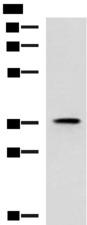 USP50 Antibody - Western blot analysis of Mouse adrenal gland tissue lysate  using USP50 Polyclonal Antibody at dilution of 1:400