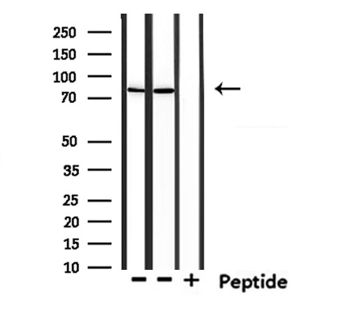 USP51 Antibody - Western blot analysis of extracts of mouse muscle and mouse brain tissue using USP51 antibody.