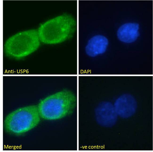 USP6 / HRP1 Antibody - USP6 / HRP1 antibody immunofluorescence analysis of paraformaldehyde fixed A431 cells, permeabilized with 0.15% Triton. Primary incubation 1hr (10ug/ml) followed by Alexa Fluor 488 secondary antibody (2ug/ml), showing cytoplasmic/vesicle staining. The nuclear stain is DAPI (blue). Negative control: Unimmunized goat IgG (10ug/ml) followed by Alexa Fluor 488 secondary antibody (2ug/ml).
