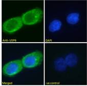 USP6 / HRP1 Antibody - USP6 / HRP1 antibody immunofluorescence analysis of paraformaldehyde fixed A431 cells, permeabilized with 0.15% Triton. Primary incubation 1hr (10ug/ml) followed by Alexa Fluor 488 secondary antibody (2ug/ml), showing cytoplasmic/vesicle staining. The nuclear stain is DAPI (blue). Negative control: Unimmunized goat IgG (10ug/ml) followed by Alexa Fluor 488 secondary antibody (2ug/ml).