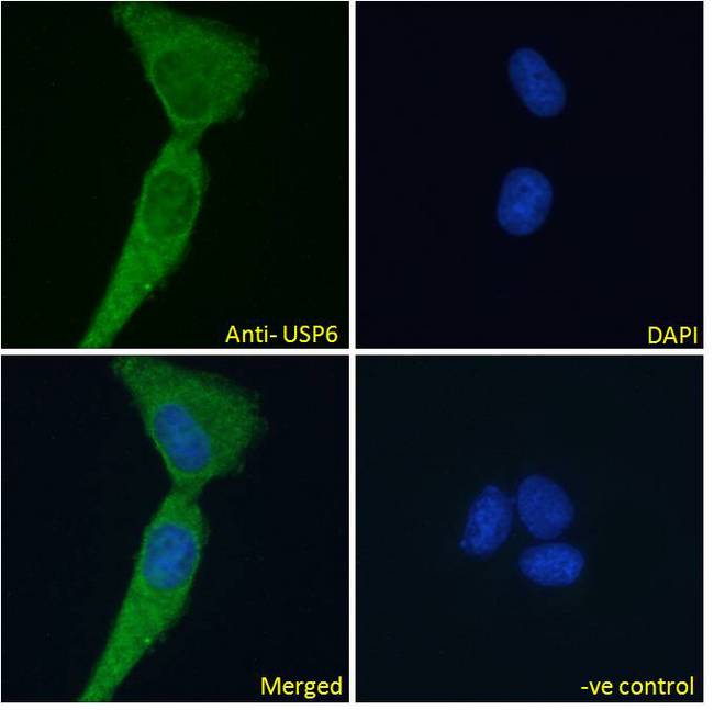 USP6 / HRP1 Antibody - USP6 / HRP1 antibody immunofluorescence analysis of paraformaldehyde fixed U2OS cells, permeabilized with 0.15% Triton. Primary incubation 1hr (10ug/ml) followed by Alexa Fluor 488 secondary antibody (2ug/ml), showing cytoplasmic staining. The nuclear stain is DAPI (blue). Negative control: Unimmunized goat IgG (10ug/ml) followed by Alexa Fluor 488 secondary antibody (2ug/ml).