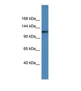 USP6 / HRP1 Antibody - Western blot of Human Jurkat. USP6 antibody dilution 1.0 ug/ml.  This image was taken for the unconjugated form of this product. Other forms have not been tested.