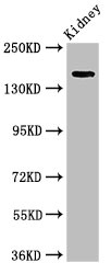 USP6 / HRP1 Antibody - Positive WB detected in:Rat kidney tissue;All lanes:USP6 antibody at 4?g/ml;Secondary;Goat polyclonal to rabbit IgG at 1/50000 dilution;Predicted band size: 159,122,90 KDa;Observed band size: 159 KDa;