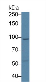 USP6NL Antibody - Western Blot; Sample: Human Lung lysate; Primary Ab: 2µg/ml Rabbit Anti-Human USP6NL Antibody Second Ab: 0.2µg/mL HRP-Linked Caprine Anti-Rabbit IgG Polyclonal Antibody