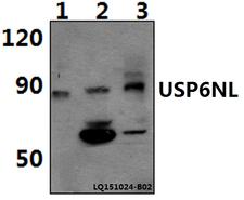 USP6NL Antibody - Western blot of USP6NL polyclonal antibody at 1:500 dilution. Lane 1: Jurkat whole cell lysate (40 ug). Lane 2: PC12 whole cell lysate (40 ug). Lane 3: RAW264.7 whole cell lysate (40 ug).